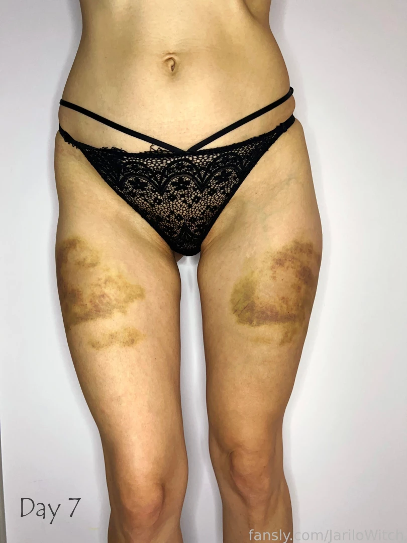 I got a serious can1ng two weeks ago since then i documented the part 7 