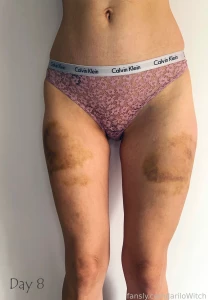 I got a serious can1ng two weeks ago since then i documented the part 1