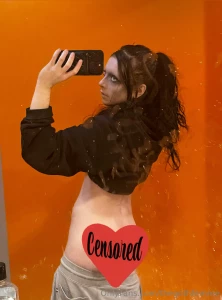 Hope you like my back scar i think it looks cool