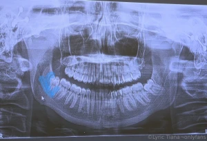 Hey everyone as you may or may not know i ve been sick since mid may i