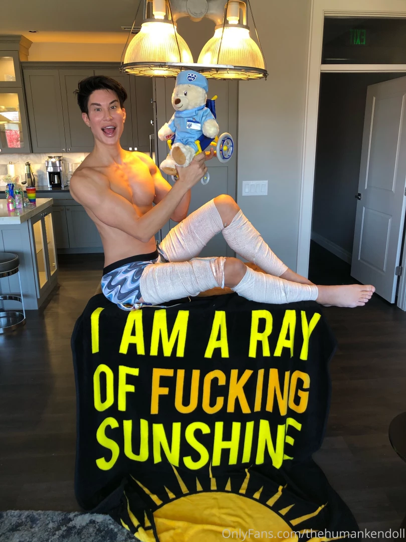 Sneak peek of my most recent plastic surgery - it s leg day after 2 