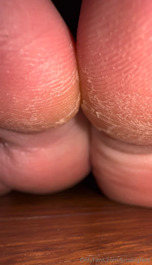 Crusty callous lovers it s been weeks since i ve used lotion on my 