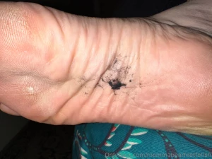 Ewww who s up for licking these