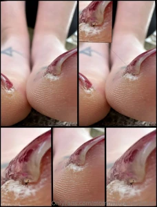 Picture of the day eat that toejam