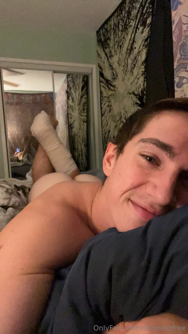 Yoooo ya boy broke his leg whoopsie check back in soon for updates part 1 