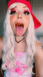 My uvula wanted to say hi