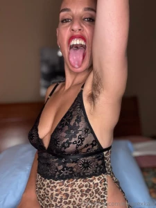 I am sick can you tell maybe if you see my tongue close up you can part 1