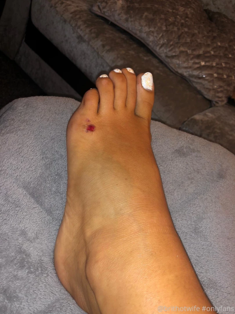 Sorry guys i was watching arsenal win and i ve hurt my ankle after a 