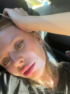 Got my lips done they re super swollen right now they ll go down like