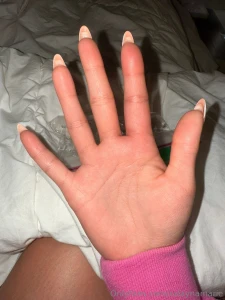 I didn t know bee stings could get this swollen