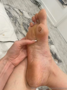 How long do you think it will take to heal this is from the black