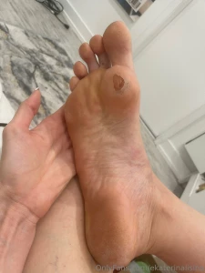 How long do you think it will take to heal this is from the black part 2