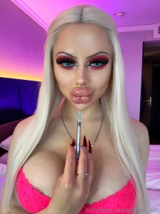 Lips augmentation is my passion