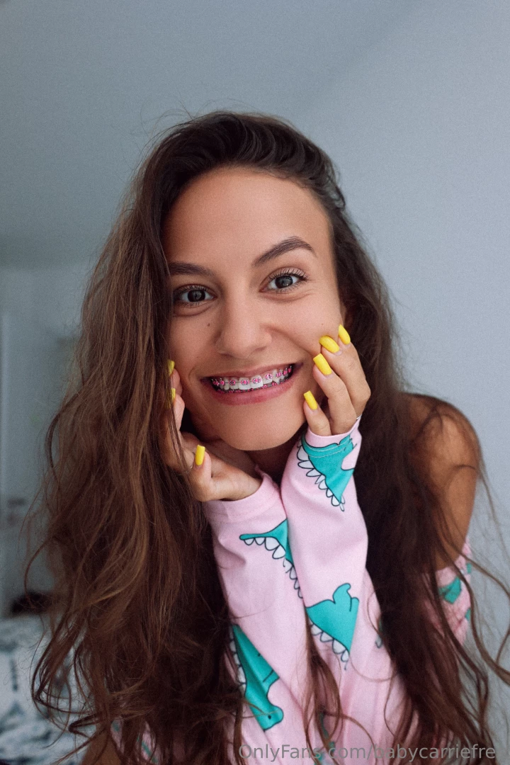 I put braces with pink elastic bands back on it was very important to part 1 