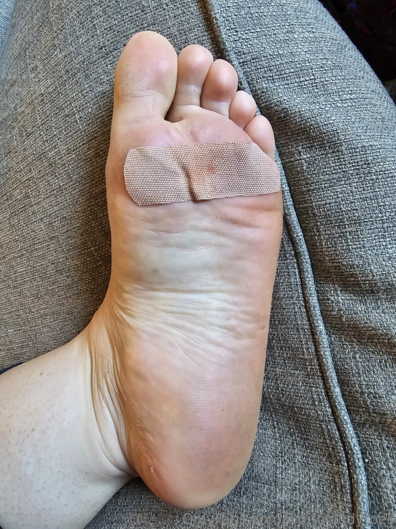 Ouchhhh stepped on a tiny shard of glass that went deep send kisses 