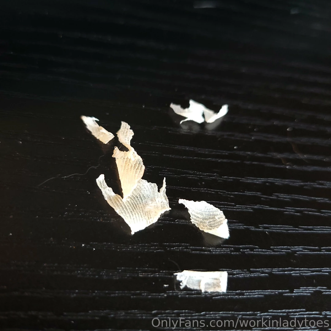 Ugggh picking lots of dry skin off my right foot 