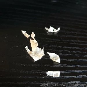 Ugggh picking lots of dry skin off my right foot