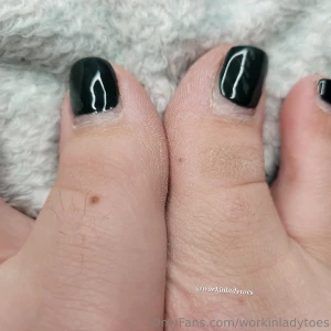Up close toe photos for your viewing pleasure
