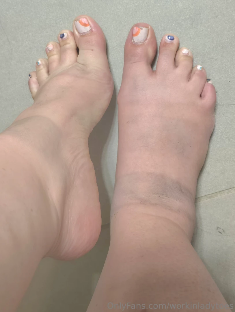 Post-club feet definitely painting my toes tomorrow oof wore my dr part 2 