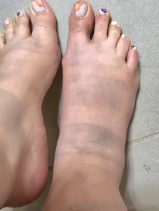 Post-club feet definitely painting my toes tomorrow oof wore my dr part 3