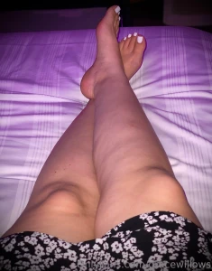 Need to put these feet up would love some tlc
