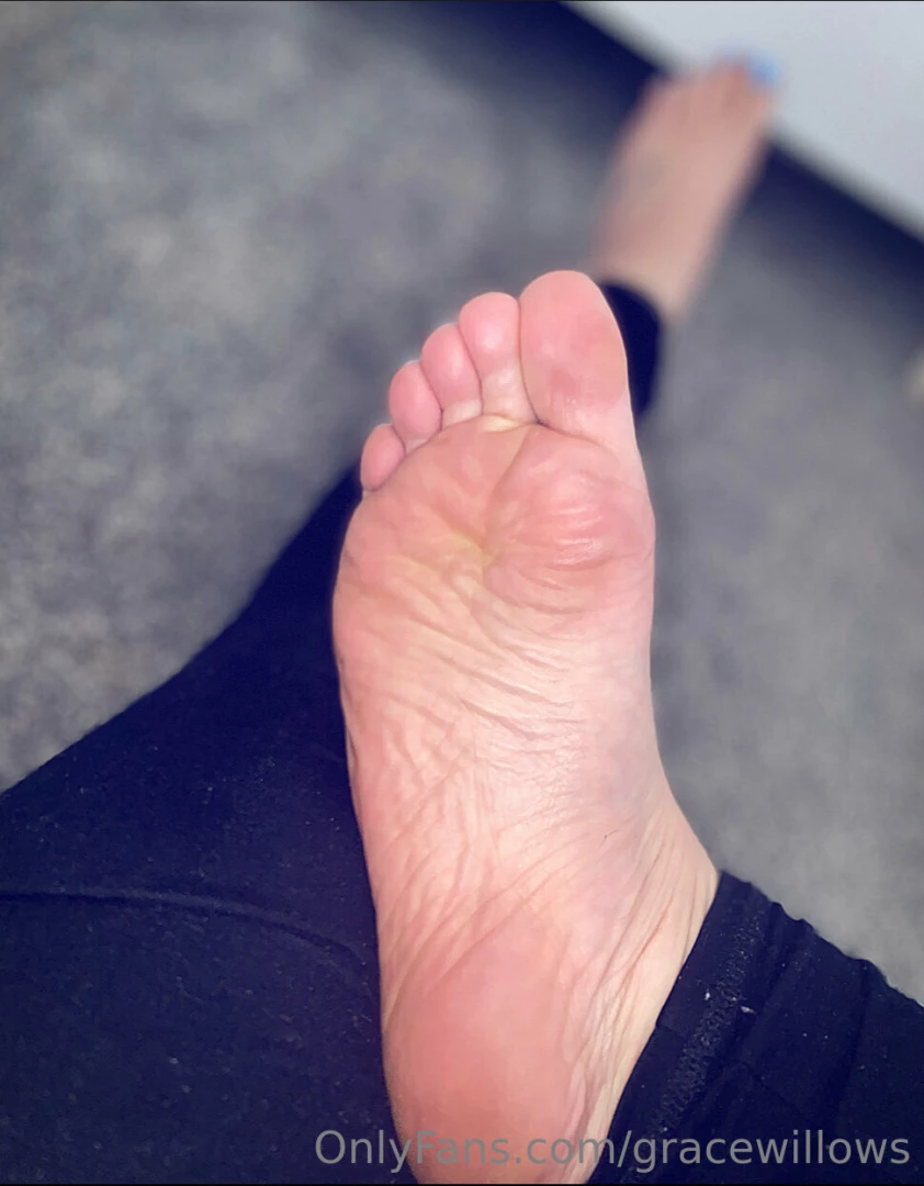 Sore soles need attention 