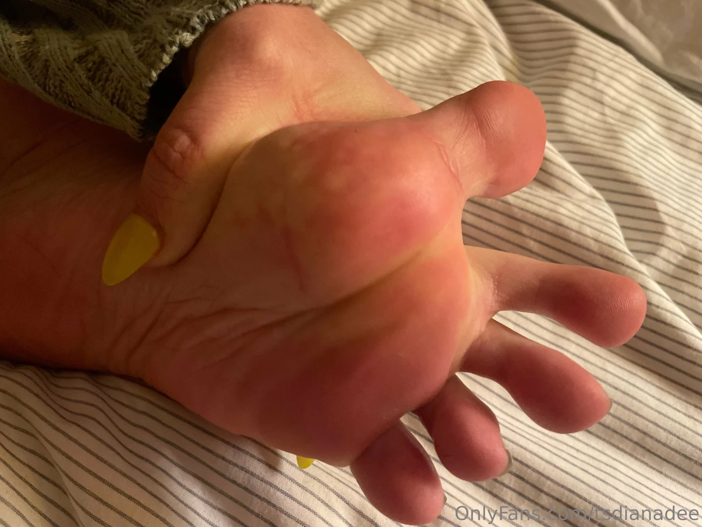 Wrinkled sole and hole part 2 