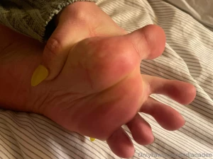Wrinkled sole and hole part 2