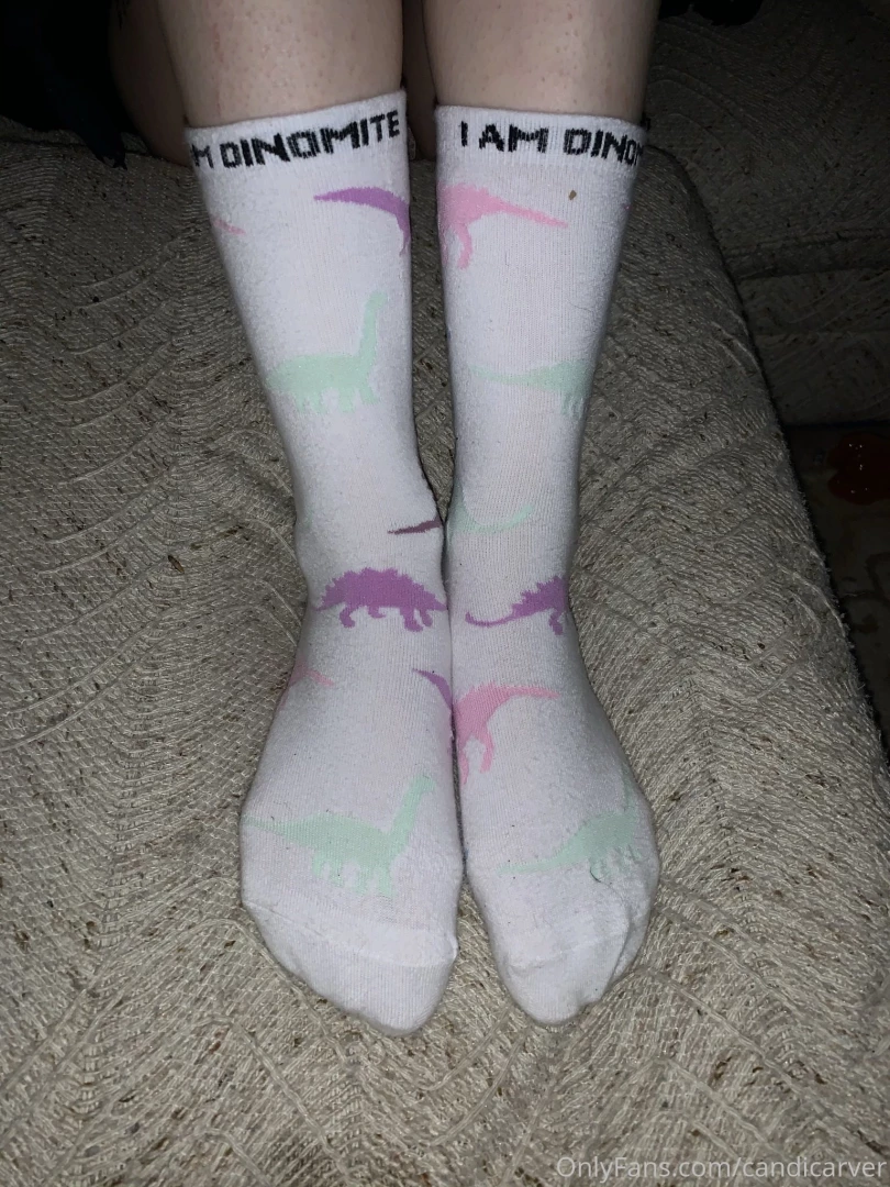 Should i post more pictures of my feet part 2 