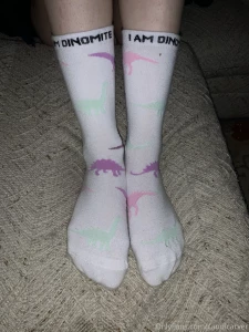 Should i post more pictures of my feet part 2