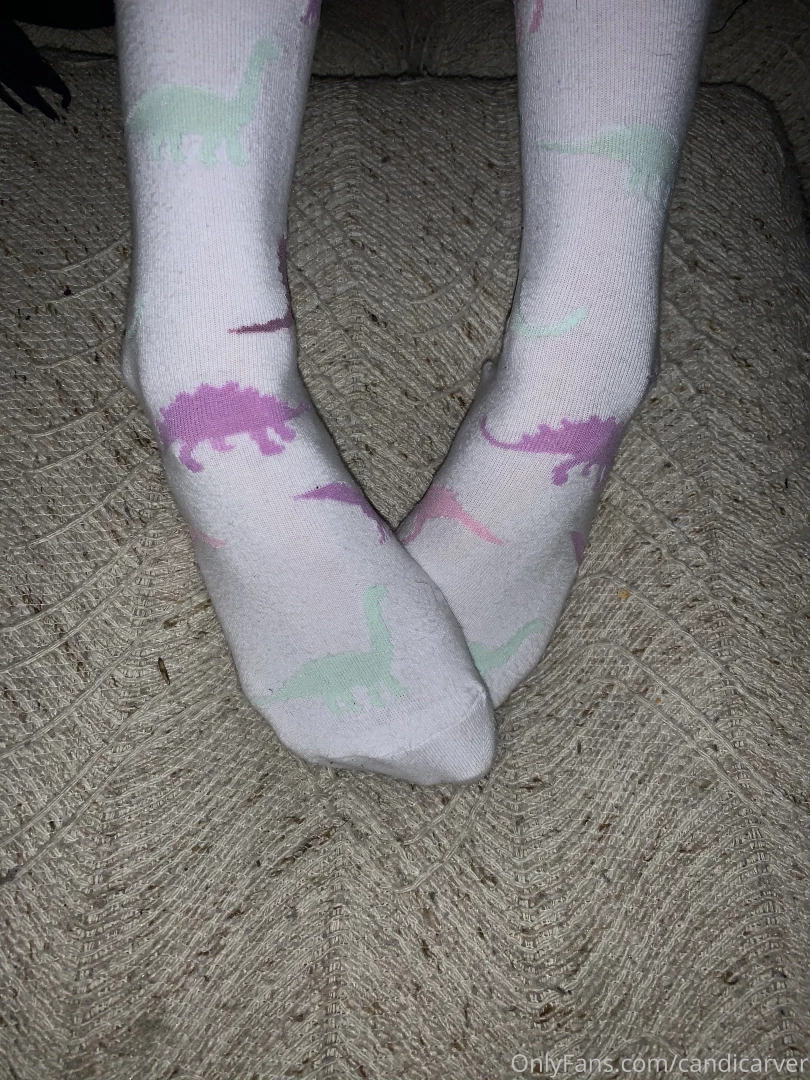 Should i post more pictures of my feet 