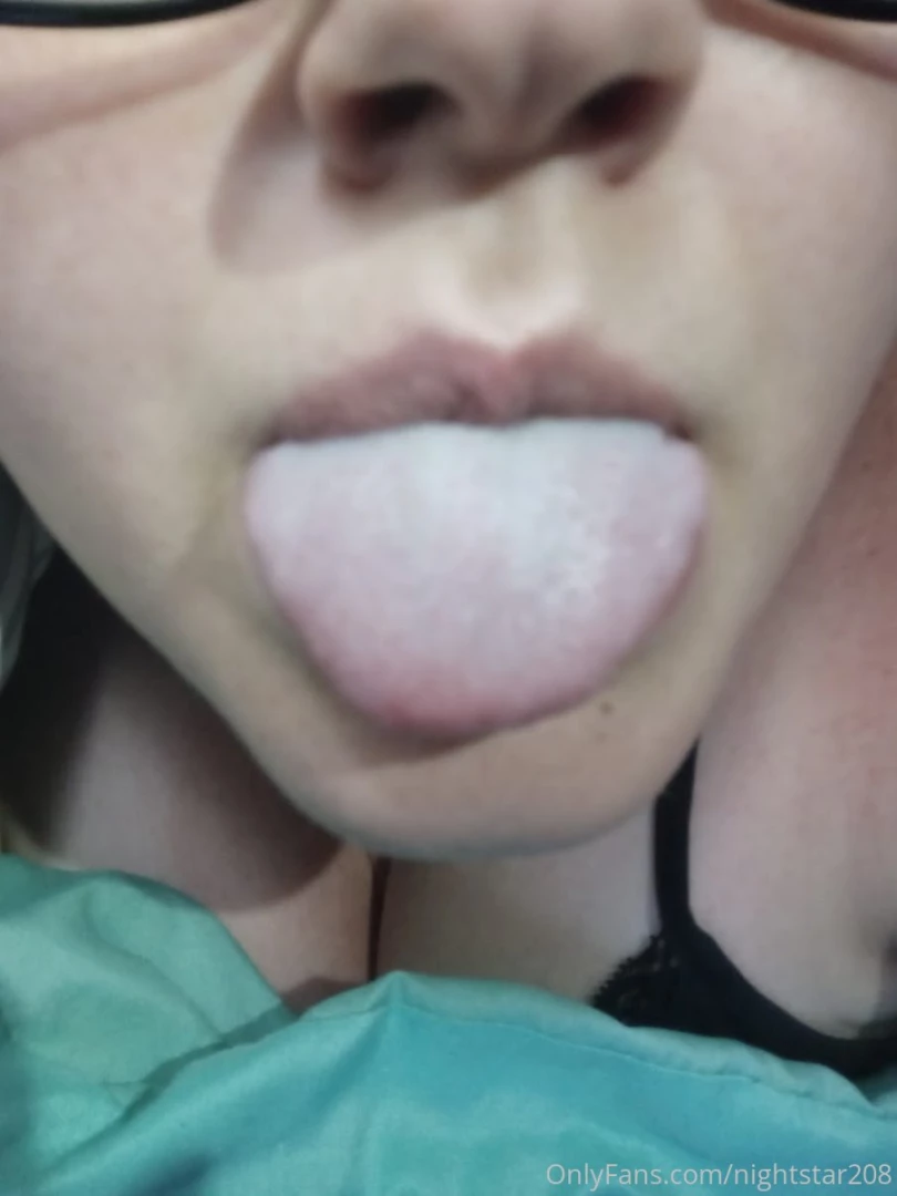 So the vaccine turned my tongue white and it has this weird texture 