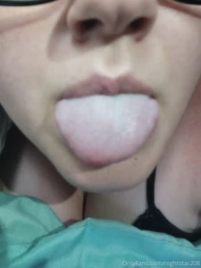 So the vaccine turned my tongue white and it has this weird texture