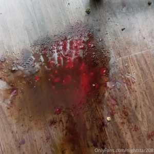 Waring graphic content my dog was attacked on oct 1st he is getting part 2