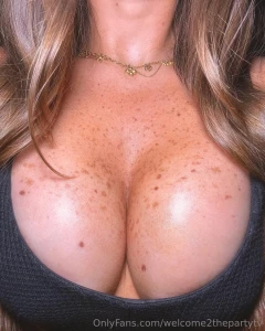 Do you like freckles part 3