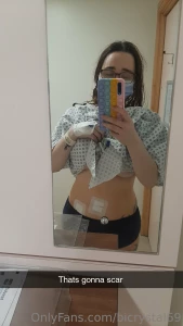 Well that s going to leave a scar but once i m recovered you can look