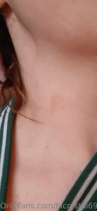 Its been days and i still can t sit properly and have random marks and