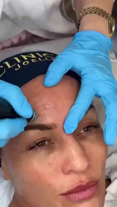 Clinica joelle clinica joelle is an aesthetic clinic that specializes part 3 