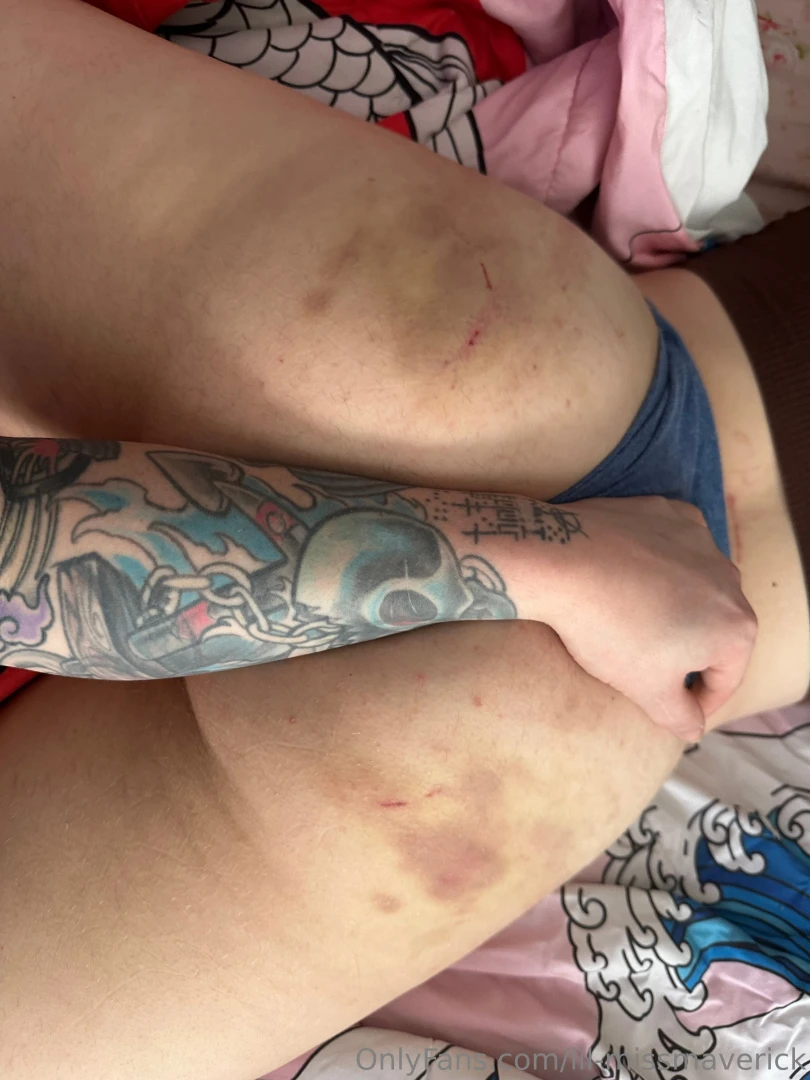 Some pictures from the last two days with my puppy part 11 