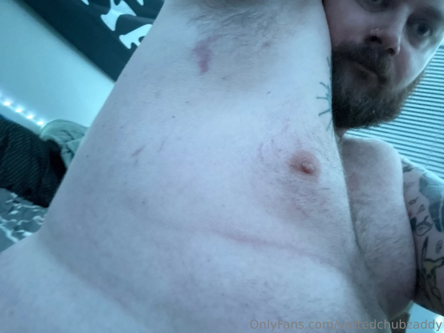 Checking out my new stretch marks on my arms and thighs 