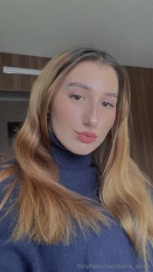 The sun got my autograph and this is the result