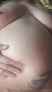 All these new stretch marks take a lot of tlc