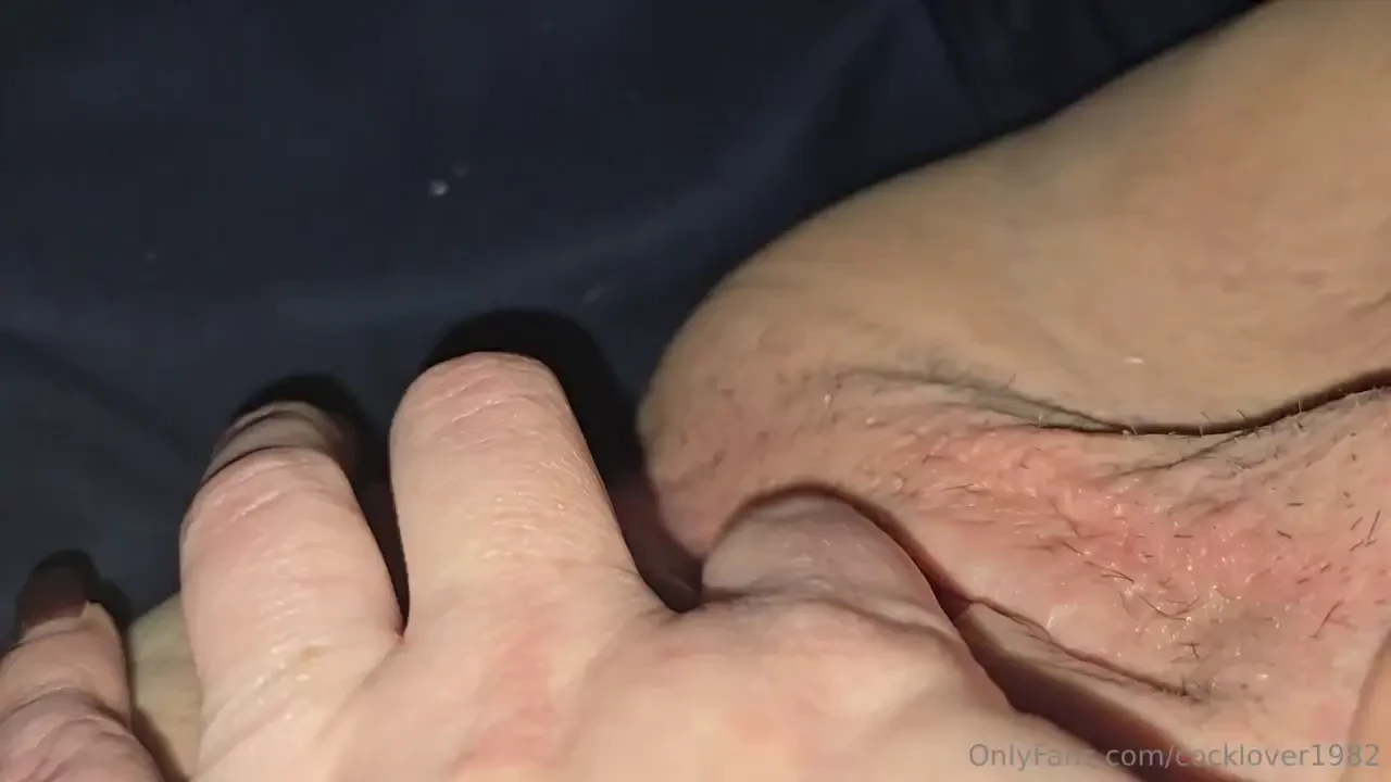 Anybody in the redding or anderson area that want to remove my finger 