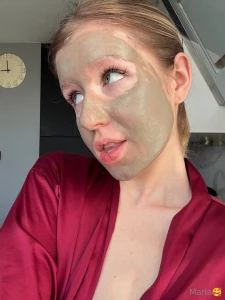 Good morning i m wearing a mask to prevent swelling part 1