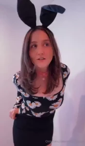 Showing my random bruise on my butt idk where it came from haha