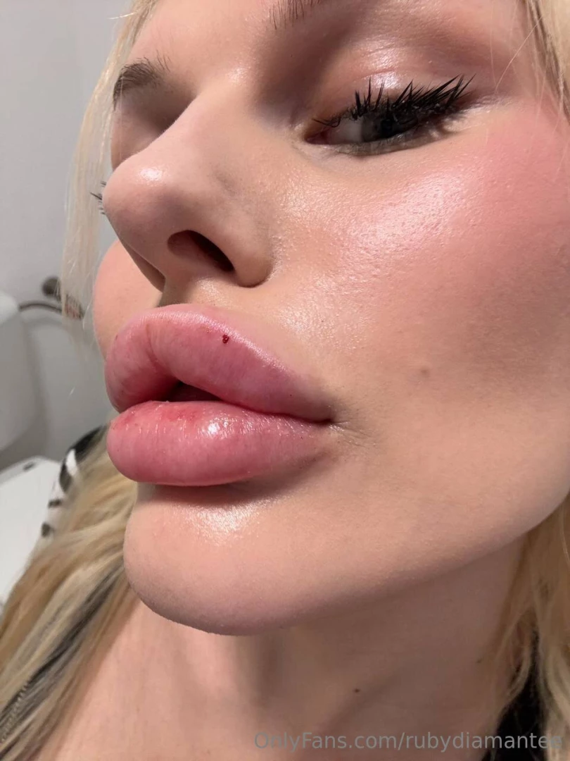 Sweet lips i decided to add a little more volume to my lips and now 