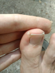 Some foot skin for you to gently bite off