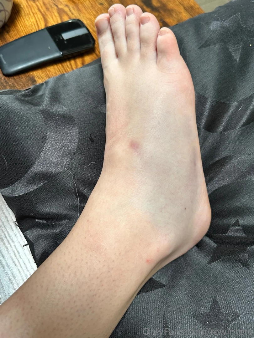 Your fave pnw hottie broke her foot and therefore can t do her regular 