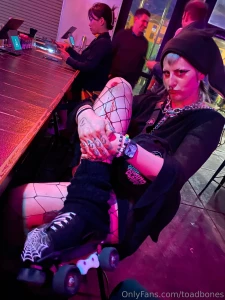 I fell on my skates kiss it better