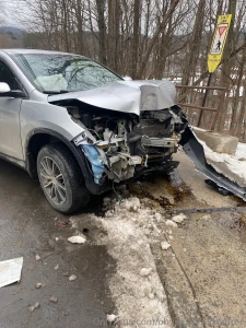 It won t allow me to post the pics of my face on here so if you want